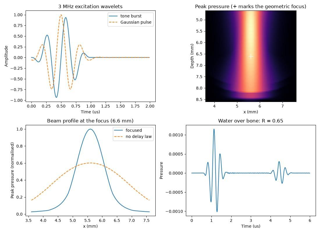_images/example_ultrasound.jpg